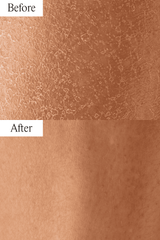 Dry Skin Bundle