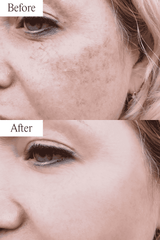 Pigmentation Bundle