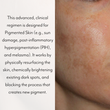 Hyperpigmentation Bundle