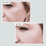 Hyperpigmentation Bundle