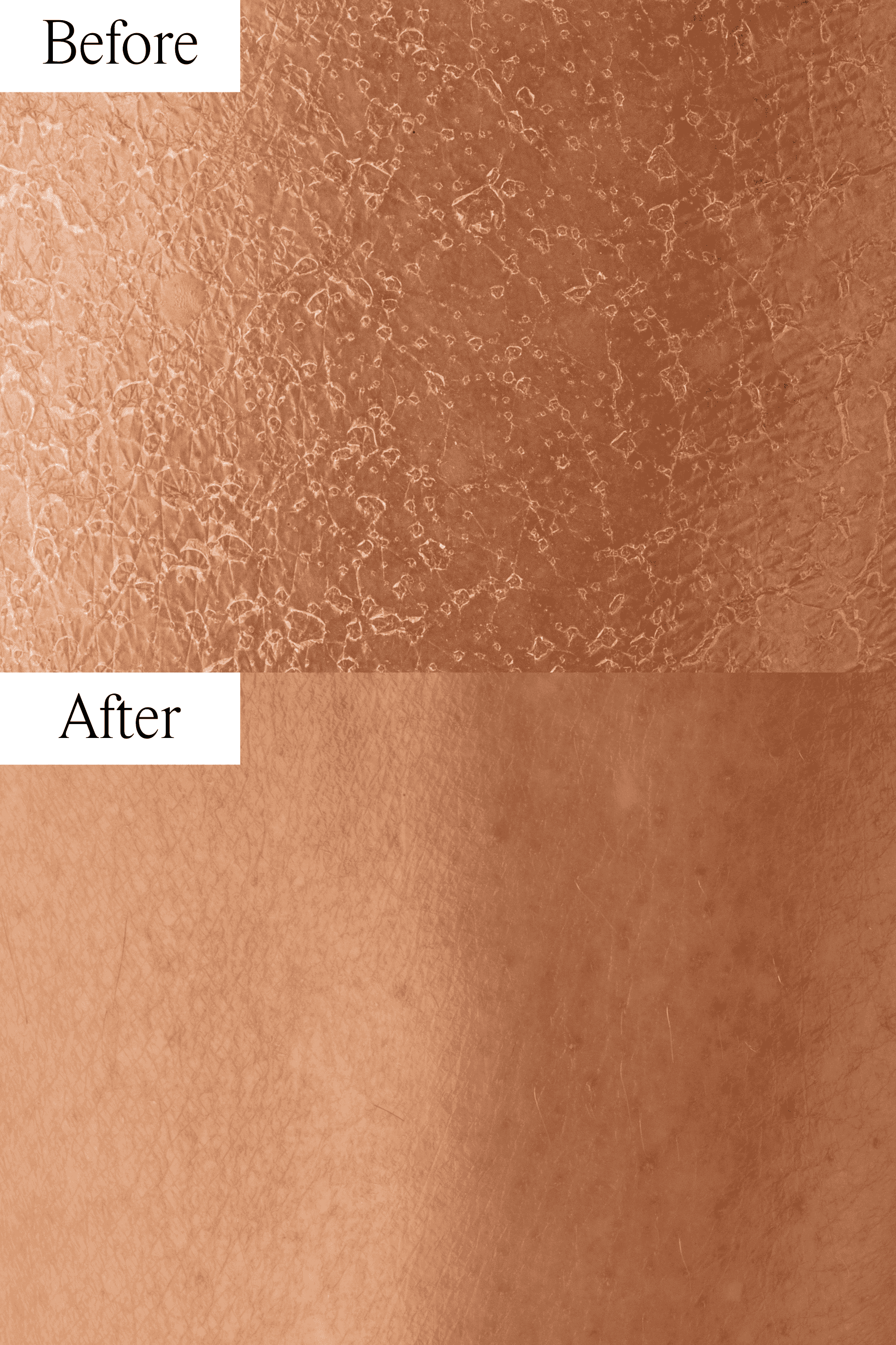 Dry Skin Bundle